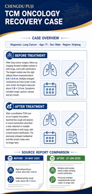 English case poster preview: Lung Cancer After Surgery