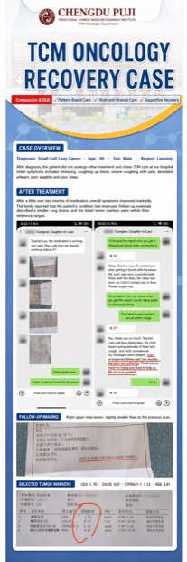 English case poster preview: Small-Cell Lung Cancer